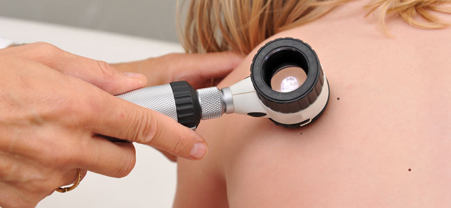 Câncer de pele nas crianças