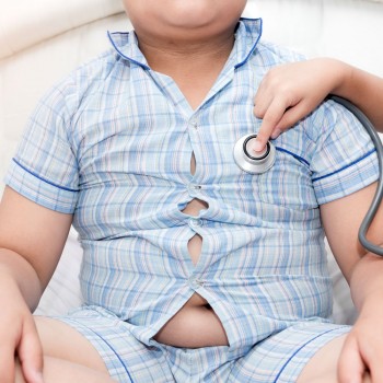 Obesidade infantil. Criança com sobrepeso