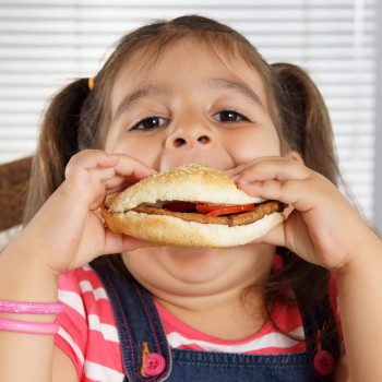 Causas da obesidade infantil