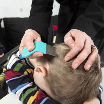 Coceira, ardor e irritabilidade. Seu filho tem piolhos?