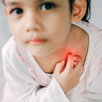 Tratamento preventivo da malária