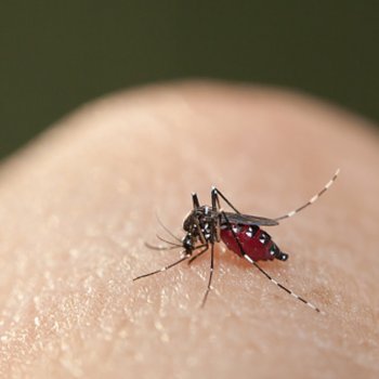 O zika vírus causa microcefalia em recém-nascidos