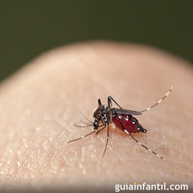 O zika vírus causa microcefalia em recém-nascidos
