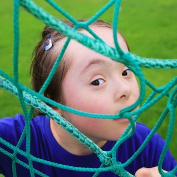 Menos crianças com Síndrome de Down