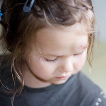 A criança bateu a cabeça. Como agir?