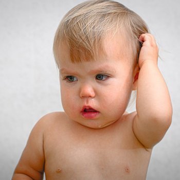 Os piolhos também afetam aos bebês
