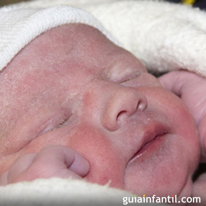 Meu bebê tem uma mancha na pele
