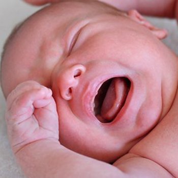 Por que não se deve forçar a pele do prepúcio do bebê