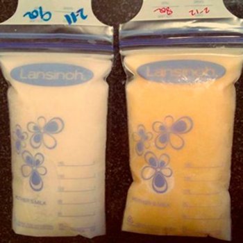 Incrível foto do poder do leite materno para curar o bebê