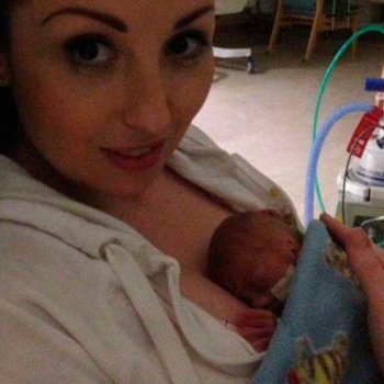 O bebê mais prematuro do mundo antes e depois