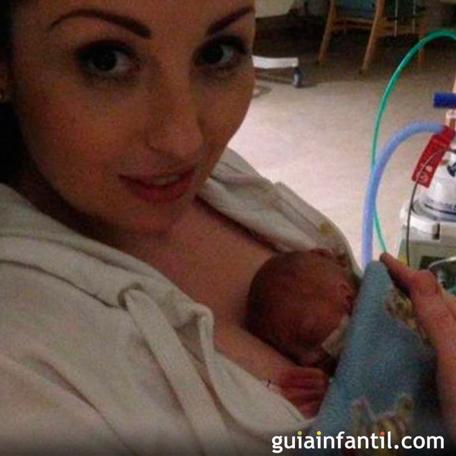 O bebê mais prematuro do mundo antes e depois