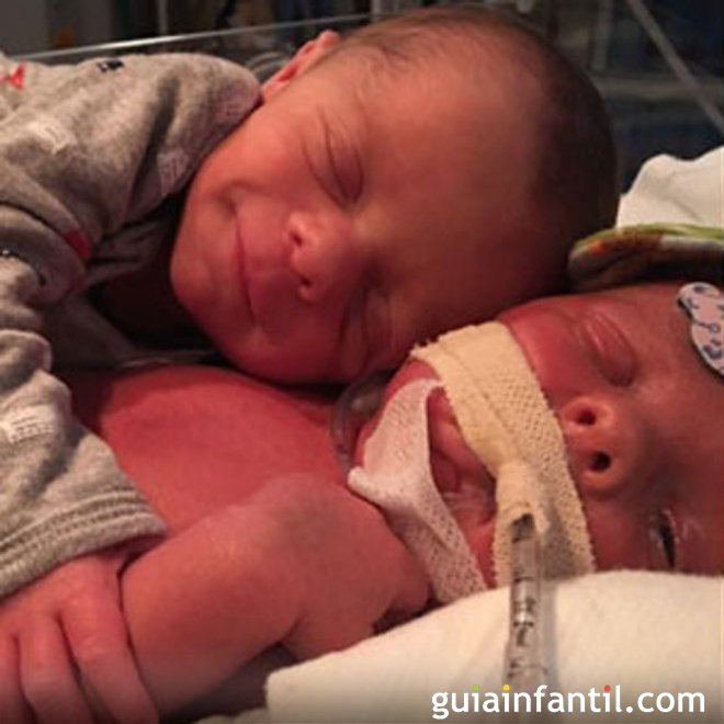 O comovente abraço de um bebê ao seu irmãozinho gêmeo após o parto