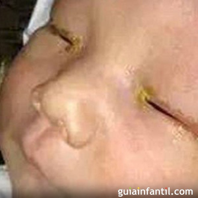 O risco de deixar cego a um bebê por usar o flash numa fotografia