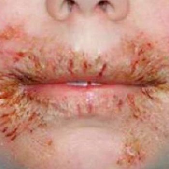 Evite as toalhinhas úmidas pela saúde do seu bebê