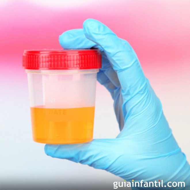 Infecção urinária na gravidez