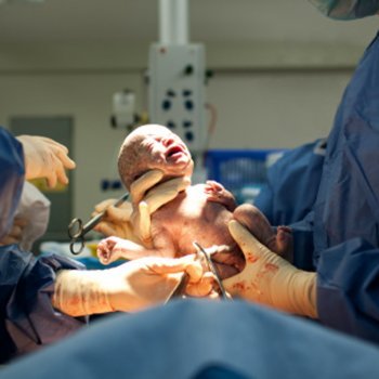 Etapas do parto: expulsão da placenta