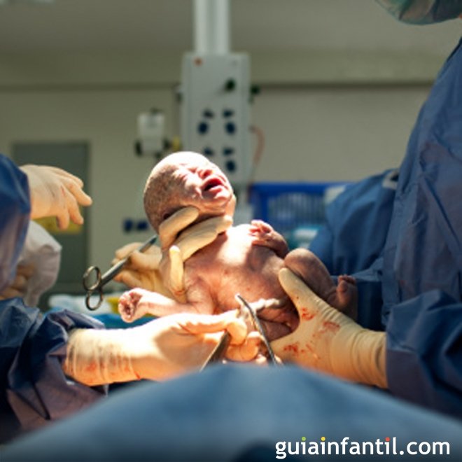 Etapas do parto: expulsão da placenta