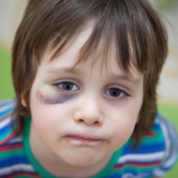 Como deve se comportar a criança quando outras crianças a agridem