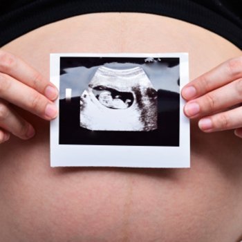 Placenta: o que é e por que é tão crucial durante a gravidez