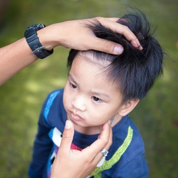 As 4 doenças que transmite o mosquito Aedes aegypti