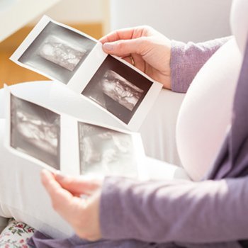 A Síndrome do gêmeo evanescente