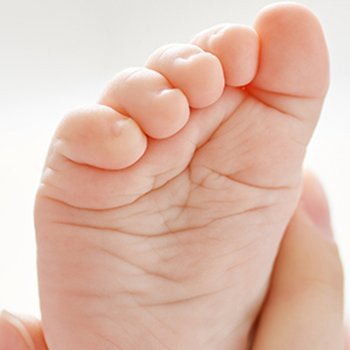 Problemas ortopédicos mais comuns nos pés das crianças