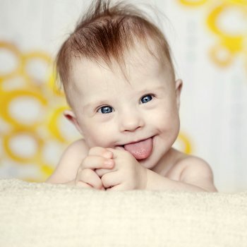 Crianças e bebês com Síndrome de Down