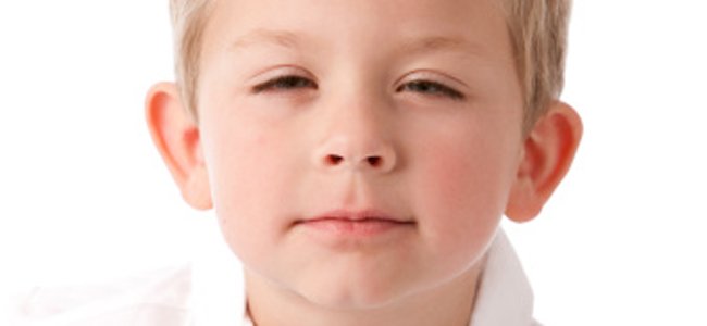 a-discriminação-crianças-vesgas-aniversários A