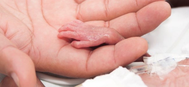 mês-de-atenção-ao-prematuro A mês-de-atenção-ao-prematuro A