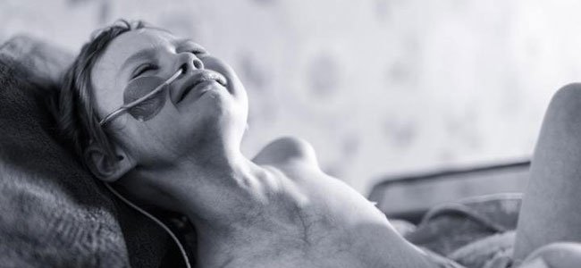 a-impactante-luta-contra-o-câncer A a-impactante-luta-contra-o-câncer A