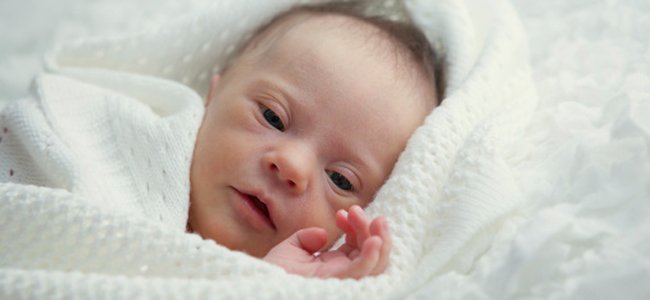 aleitamento-materno-em-bebês-síndrome-down A aleitamento-materno-em-bebês-síndrome-down A