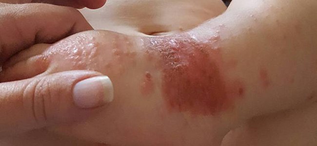 antes-de-beijar-a-um-bebê A