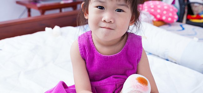 como-se-transmite-o-tétano-crianças A