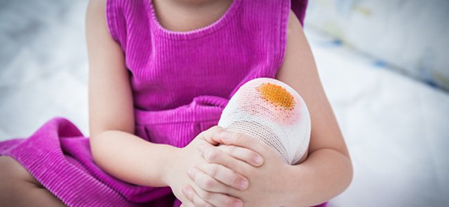 decálogo-para-cuidar-as-feridas-crianças A