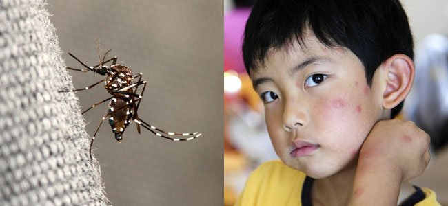 Como proteger as crianças do mosquito da dengue Como proteger as crianças do mosquito da dengue