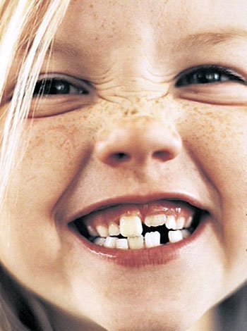 Quando uma criança quebra um dente Quando uma criança quebra um dente