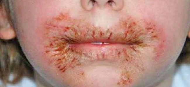 evite-as-toalhinhas-úmidas-pela-saúde A