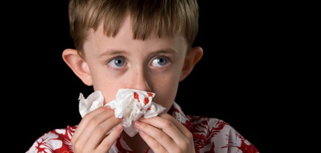 hemofilia-na-infância A hemofilia-na-infância A