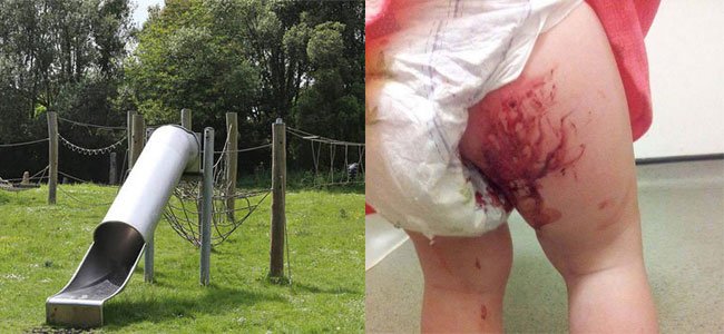 o-que-pode-acontecer-ao-seu-filho-parque A