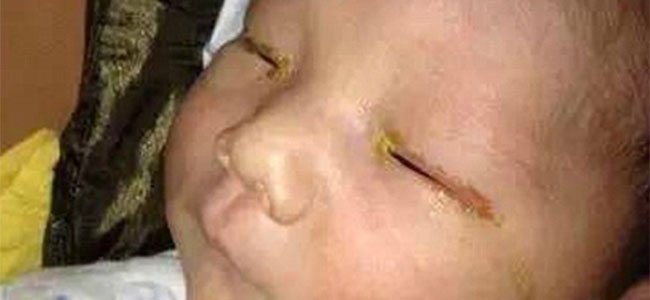o-risco-de-deixar-cego-a-um-bebê-flash A o-risco-de-deixar-cego-a-um-bebê-flash A