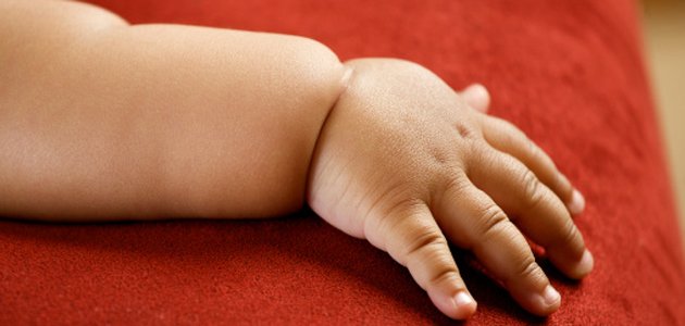 obesidade-infantil-problema mundial A