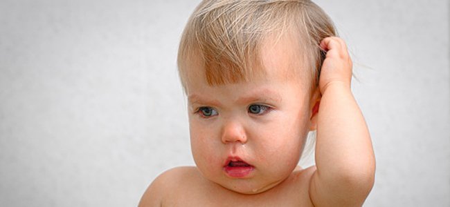 os-piolhos-também-afetam-aos-bebês A