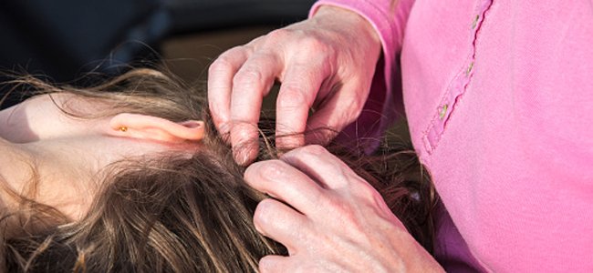 piolhos-resistentes-tratamentos-convencionais A