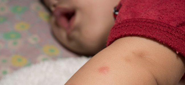 zika-vírus-e-as-crianças A zika-vírus-e-as-crianças A