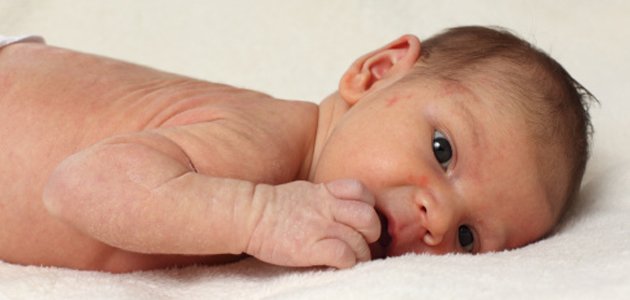 A pele seca nos bebês