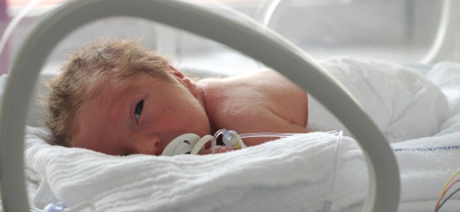 crianças-que-nascem-com-problemas-intestino A