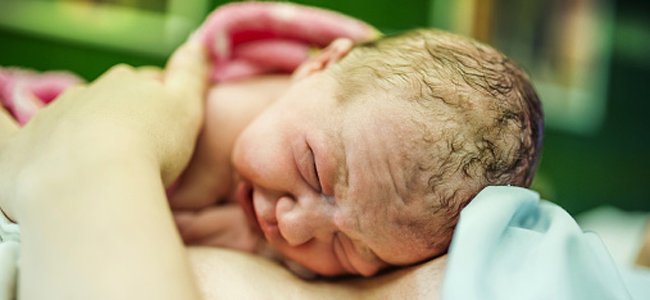 marcas-na-pele-do-recém-nascido A marcas-na-pele-do-recém-nascido A