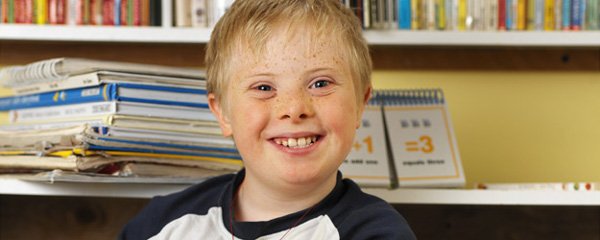 Crianças e bebês com Síndrome de Down Crianças e bebês com Síndrome de Down