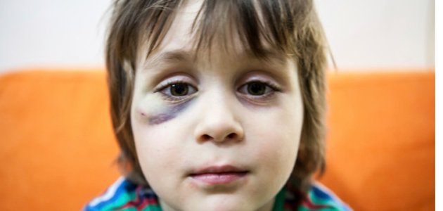 como-prevenir-maus-tratos-menino A