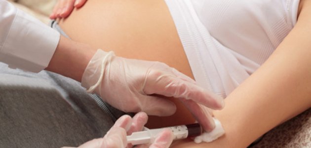 a-síndrome-de-down-no-sangue-materno A a-síndrome-de-down-no-sangue-materno A